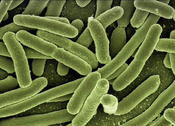 大腸菌の顕微鏡写真